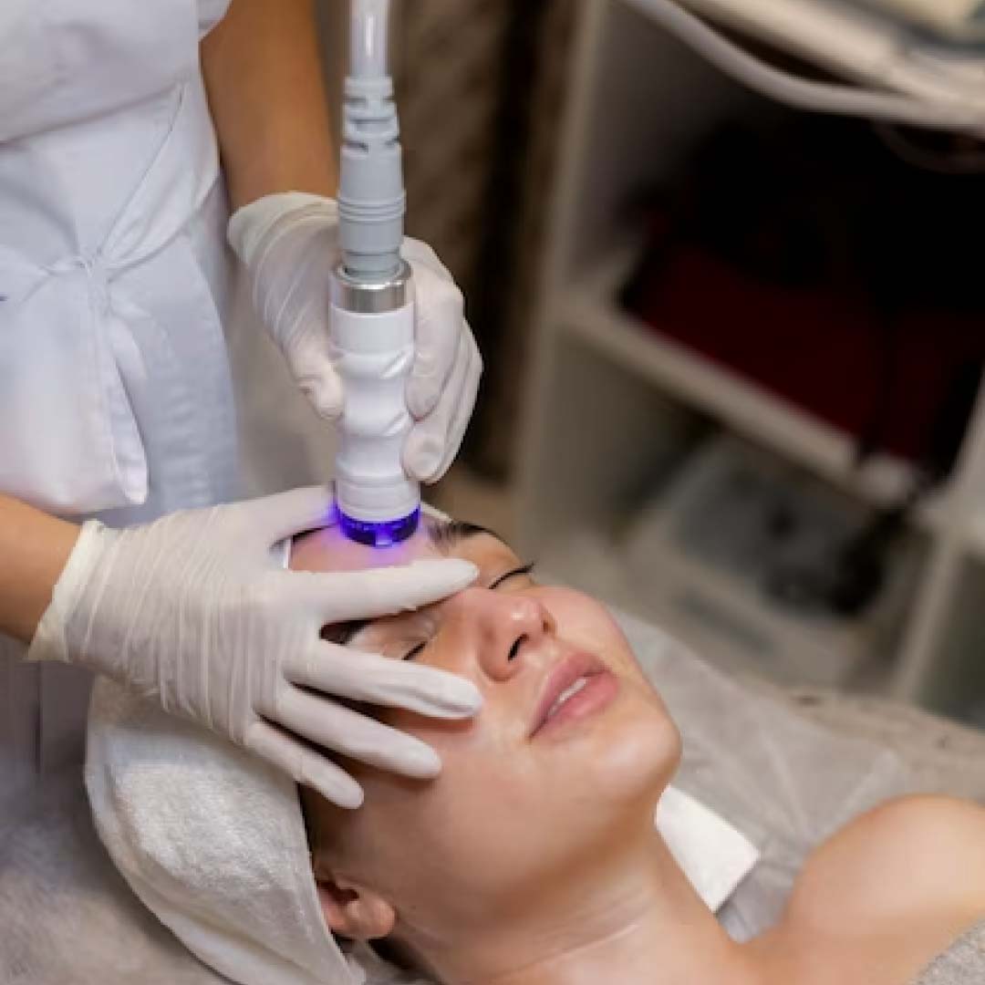 Laser Skin Rejuvenation