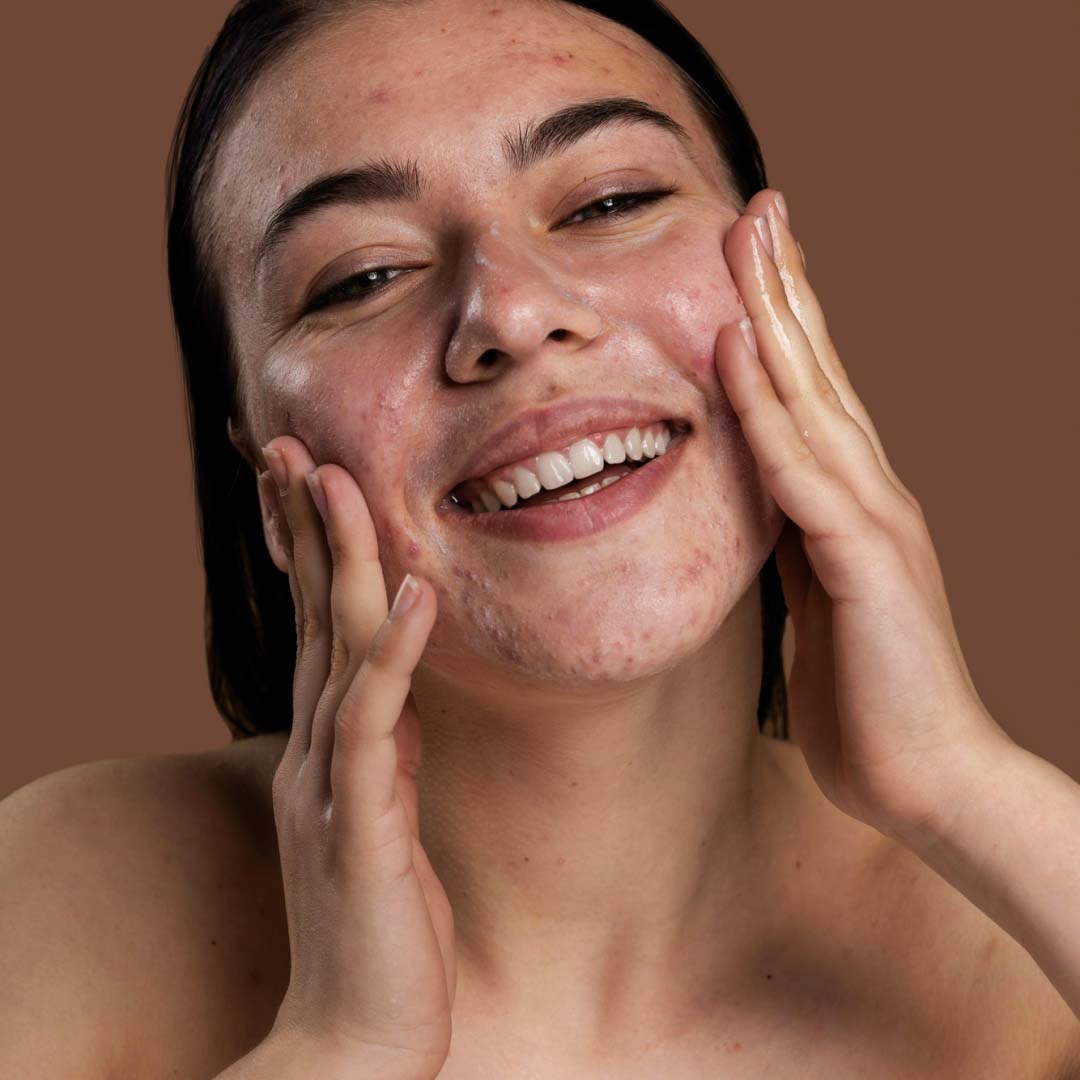 Skin Infection Treatment