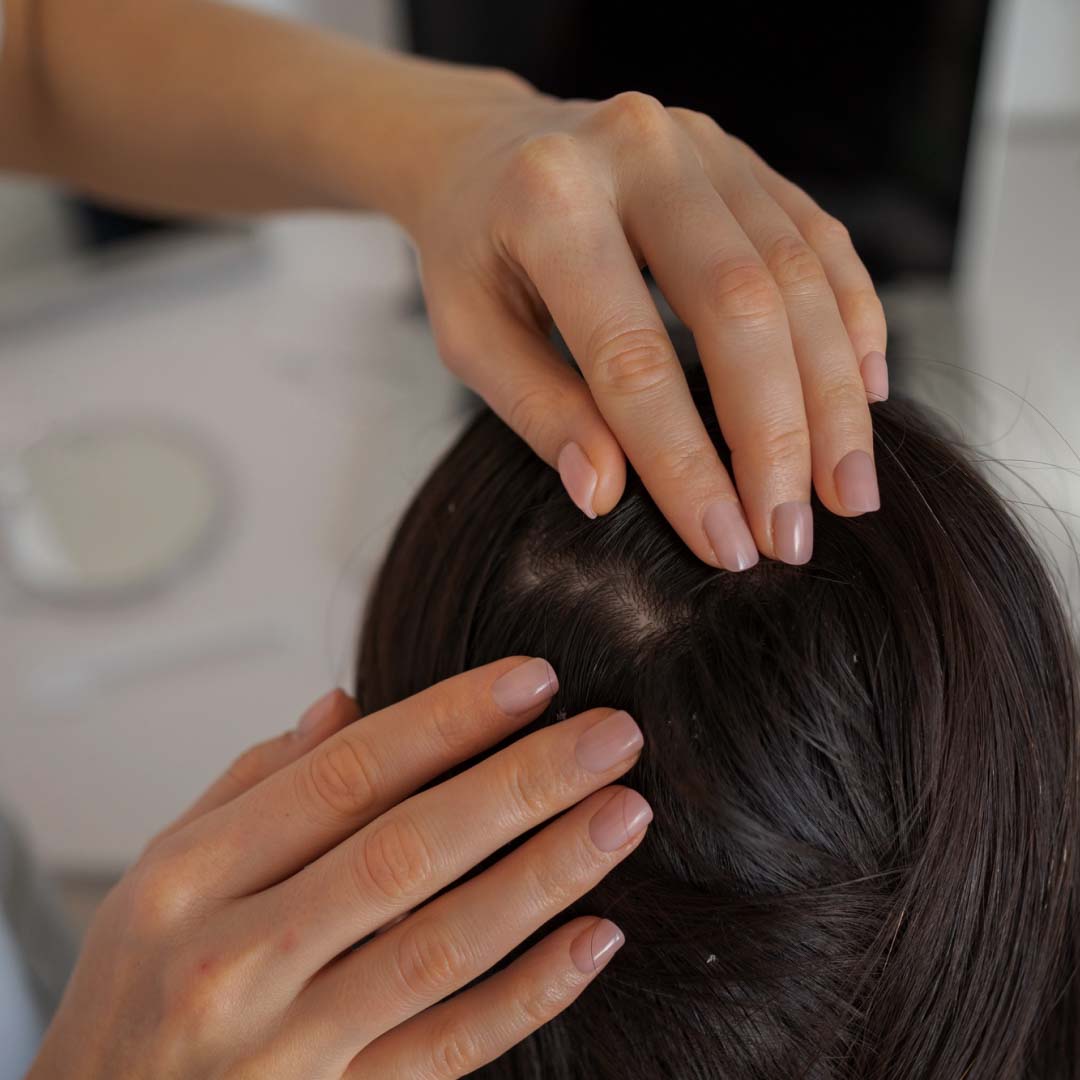 Scalp Treatment