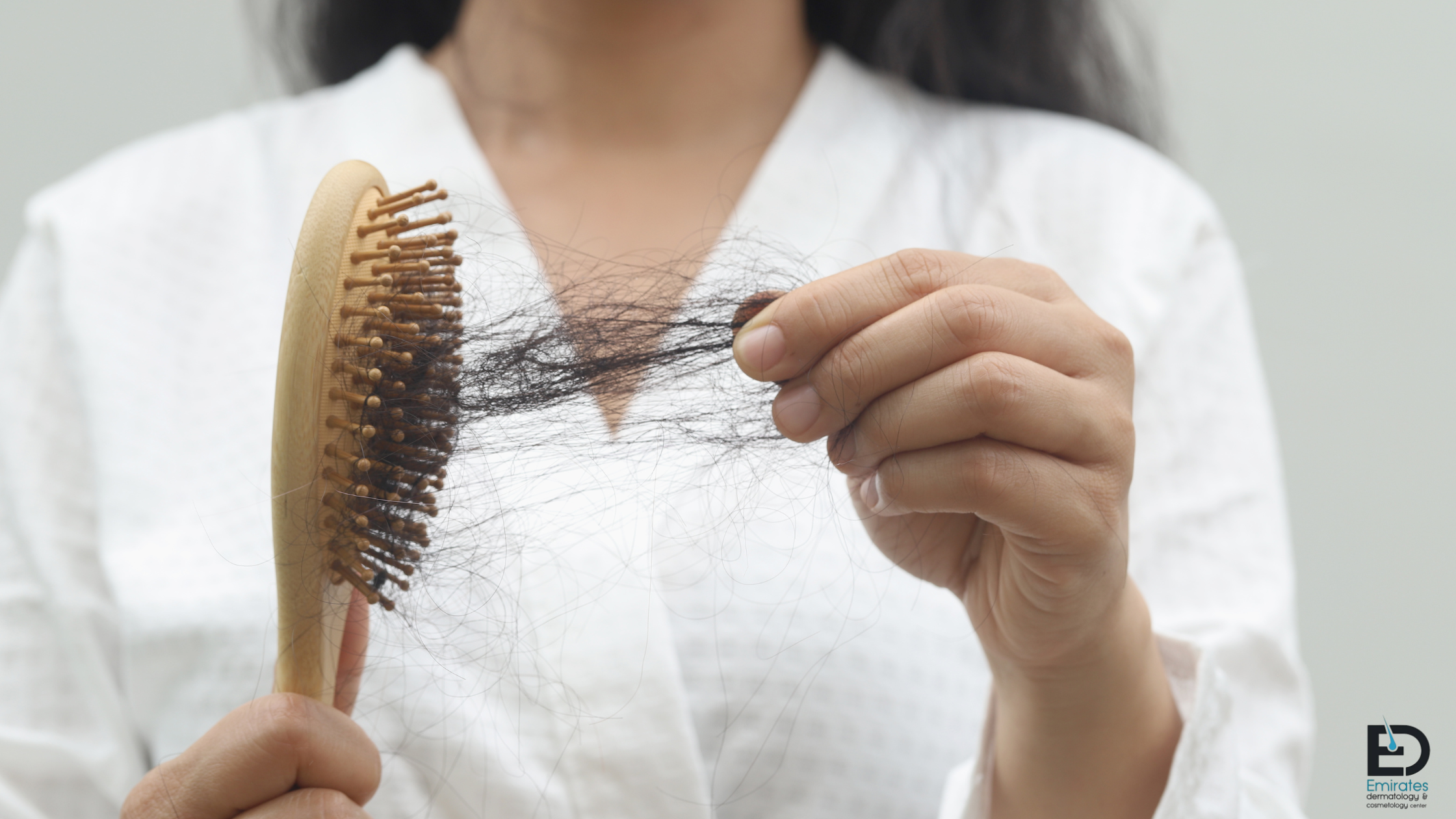 Hair Loss Treatment Is Important